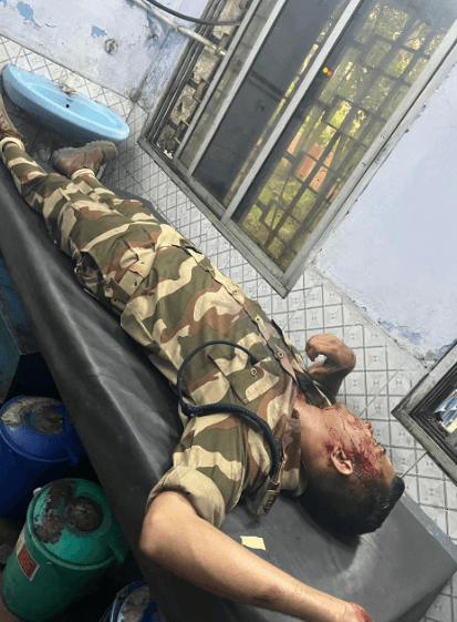 चोरी रोकने पहुंची टीम पर हमला, इंस्पेक्टर घायल